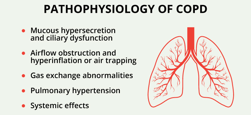 171015_WCD_Pathophysiology5