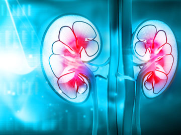 Chronic kidney disease