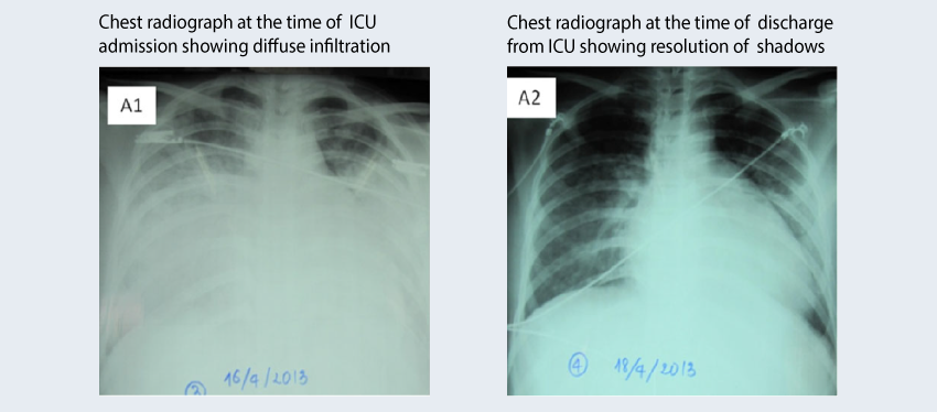 200228-Binh_2015-Fig01