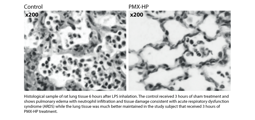 200521-Focus-On_COVID-19-and-the-gut-lung-axis_Histological-sample